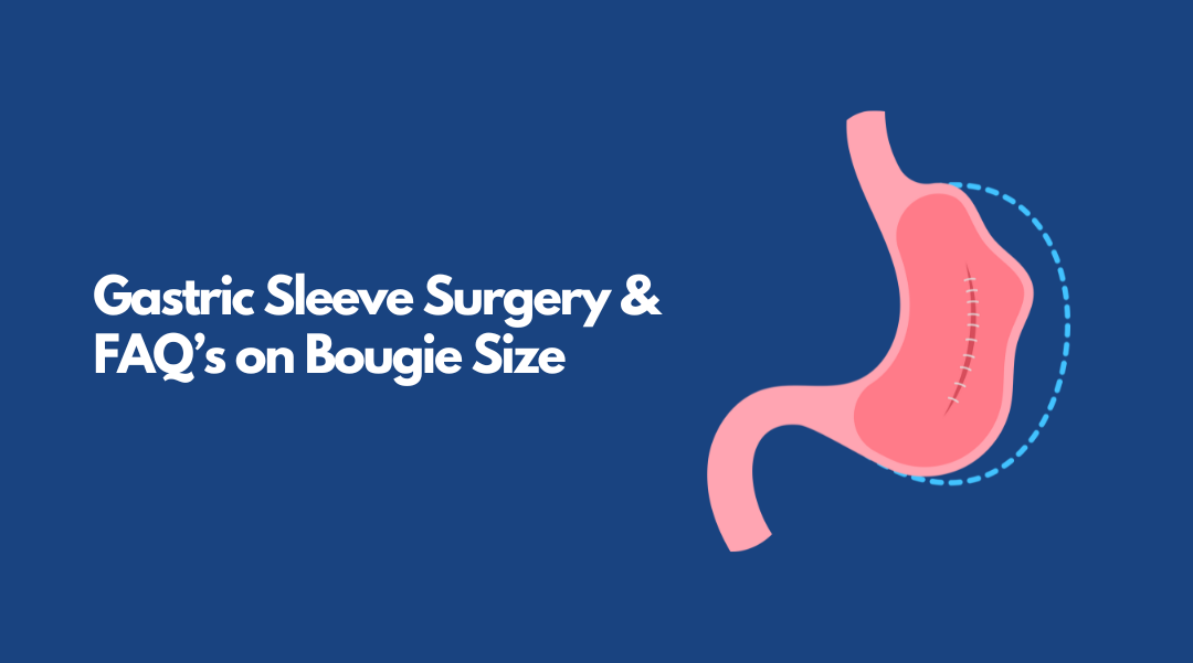 Gastric Sleeve surgery & FAQs on bougie size by Dr Ravi Rao, Perth, Western Australia