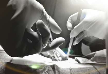 SIPS Surgery by Dr Ravi Rao, Perth Western Australia
