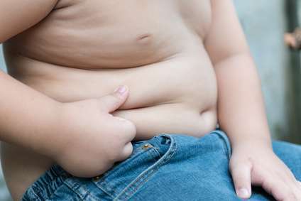 Impact of Childhood Obesity on Musculoskeletal Health
