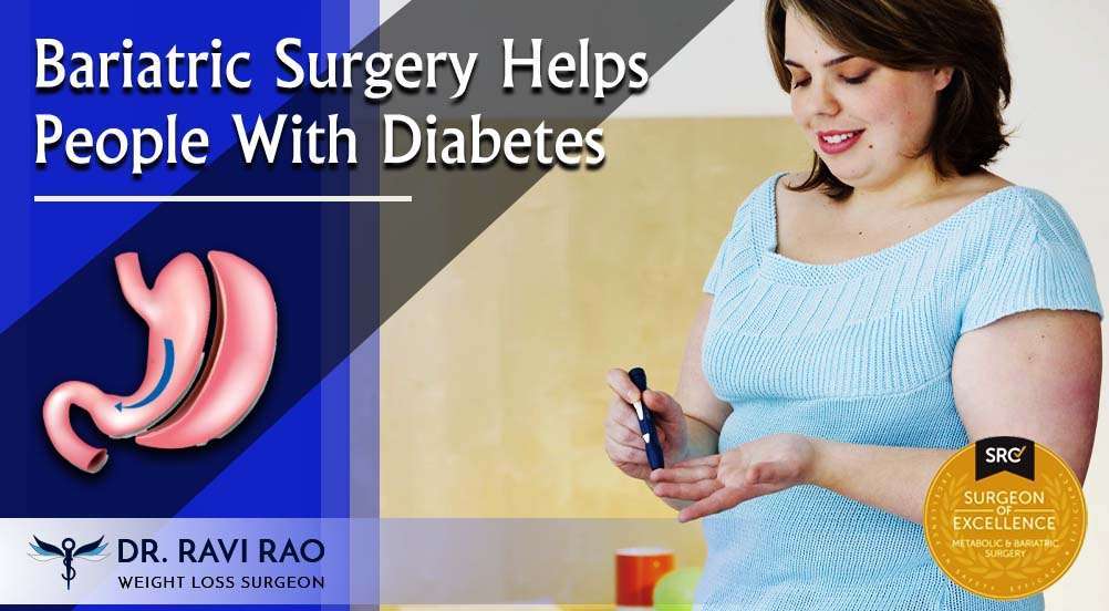 Bariatric Surgery Helps People With Diabetes