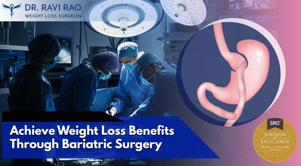 Achieve Weight Loss Benefits Through Bariatric Surgery