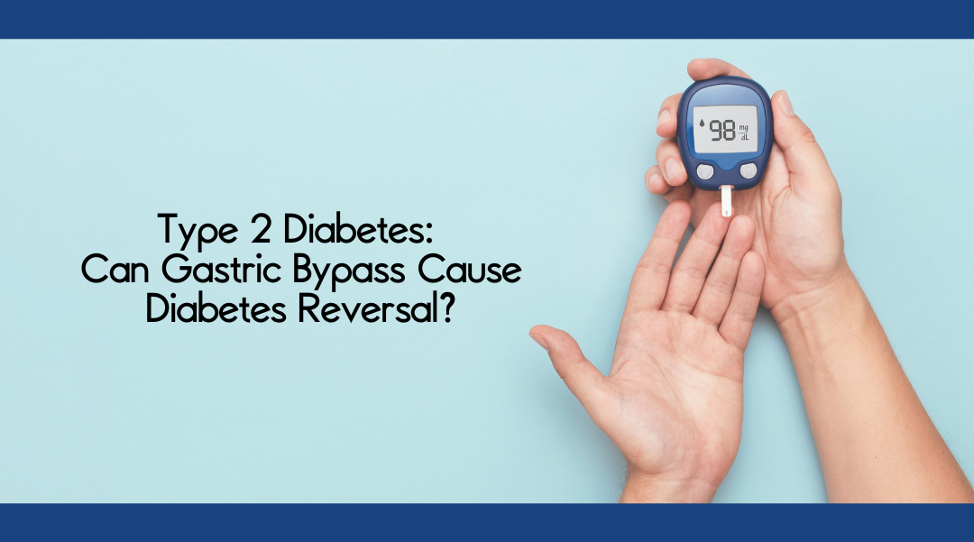 Type-2 diabetes can gastric bypass cause diabetes reversal - Dr Ravi Rao, Perth, Western Australia